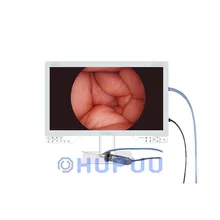 1080P 50fps 60fps CMOS medical endoscope camera Light Source 27 inch Monitor Medical Imaging system