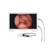 4K 8MP 3G-SDI EX-SDI CMOS medical endoscope camera Light Source 27 inch Monitor Medical Imaging system